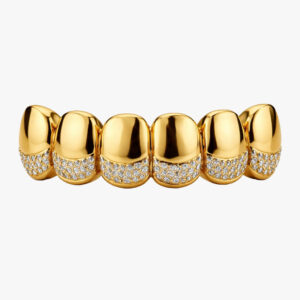 Grillz vergolden lassen